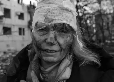 Femeia rănită din Ucraina, adevărul despre poza cu ea, devenită virală: „Totul este real. Iată bucățile de sticlă care au rămas în mine”
