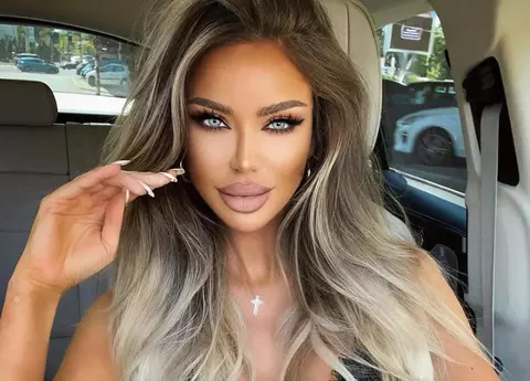 Bianca Drăgușanu a ajuns pe mâna medicilor, cu fața umflată, din cauza unei alergii: "I s-au administrat perfuzii"