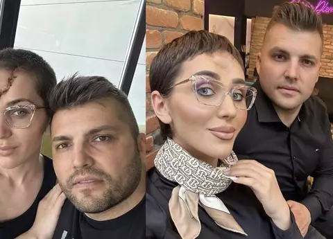 Ce spune Dana Roba despre cicatricile rămase după ce soțul ei a desfigurat-o cu ciocanul: "Îmi spun o poveste… îmi amintesc în fiecare zi că am supraviețuit" 