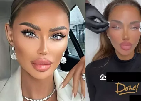 Cum arată Bianca Drăgușanu după ce și-a făcut procedura estetică "ochi de pisică": "Ne pregătim. De abia aștept"