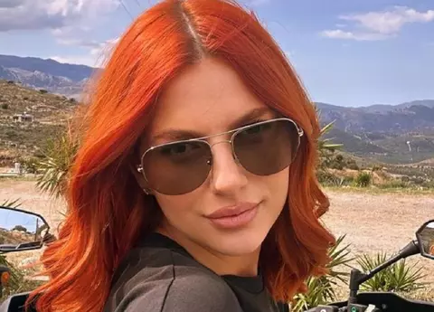 Lidia Buble a suferit de psoriazis și susține că s-a vindecat după ce tatăl ei s-a rugat, pentru ea: „Nu mi s-au mai înmulțit petele, cele care au fost efectiv au dispărut de tot. Sunt trei săptămâni de când nu mai am nimic”