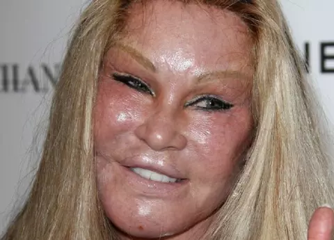 Jocelyn Wildenstein, alias Catwoman, a murit. De ce s-a stins din viață vedeta, celebră pentru operaţiile estetice extreme