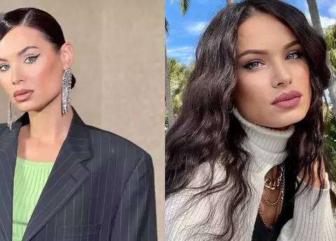 Irisha, desfigurată de o alergie. Influencerița are fața umflată și ochii iritați: „Nu mai știu ce să fac"