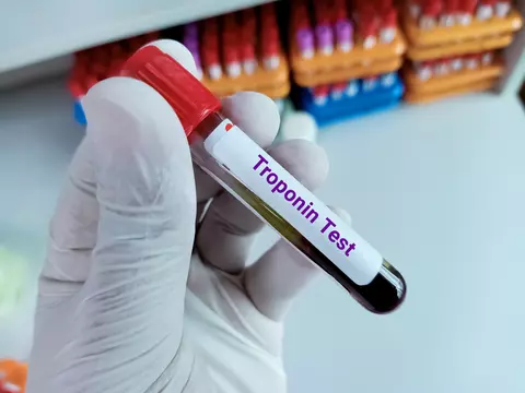 Ce sunt troponinele și ce rol au