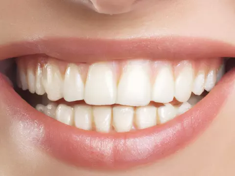 Upgrade Dental: soluții moderne pentru sănătatea și estetica zâmbetului