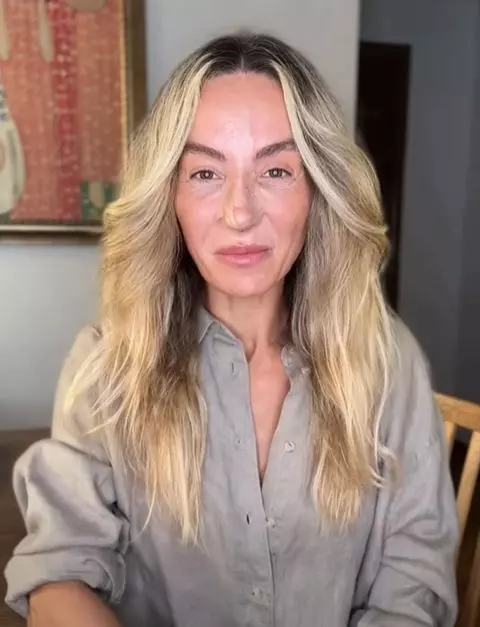 Flavia Mihășan după ce s-a operat la nas