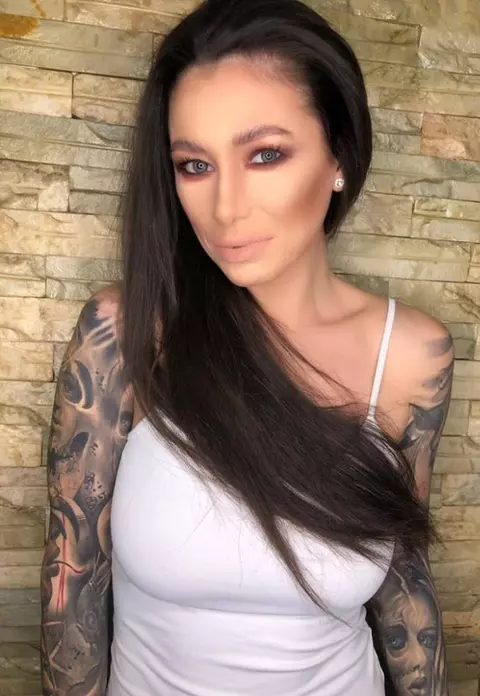Roxana Vancea și-a făcut prima operație estetică. Medicul i-a modificat nasul într-o oră și 40 de minute