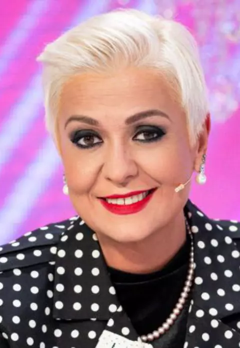 Monica Anghel, accident șocant! Artista a fost aproape desfigurată în urma unei căzături de pe cal