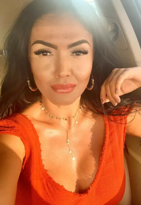 Andreea Mantea şi-a făcut o nouă intervenţie estetică, iar fanii au criticat-o imediat: „Arătai mai bine înainte!”