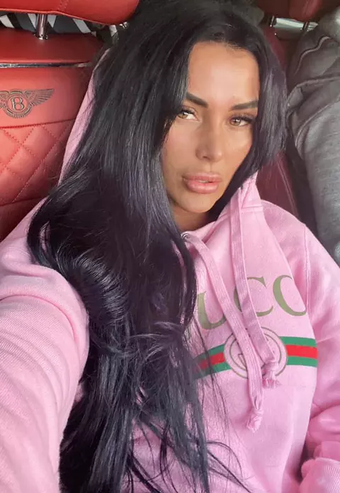 Cum arată Daniela Crudu la o săptămână după ce a fost bătută. Vedeta face primele declarații: ”Nu o să depun plângere”