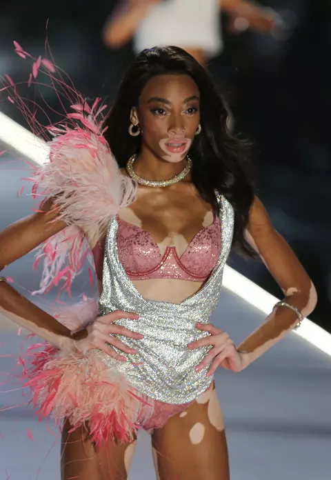 Cine este Winnie Harlow, modelul cu vitiligo. În copilărie era poreclită "zebra" și acum defilează pentru Victoria's Secret!