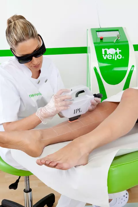 Epilare definitiva pentru pielea bronzata, la Nomasvello