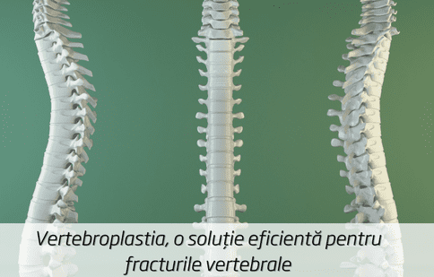 Vertebroplastia, o soluție eficientă pentru fracturile vertebrale
