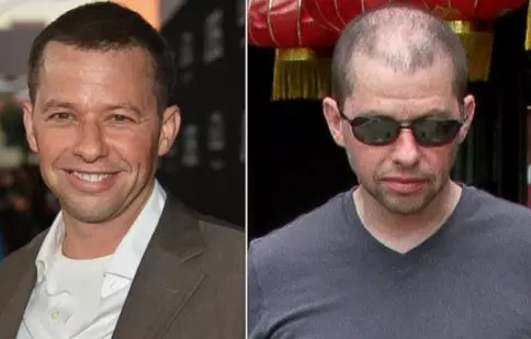 Jon Cryer din “Doi bărbaţi şi jumătate” e... aproape chel!