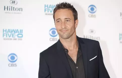 Alex O’Loughlin („Hawaii 5.0”) a pierdut 100.000 de dolari într-un incendiu