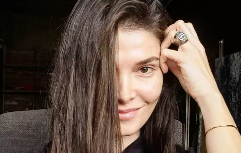 Alina Pușcaș și-a spart unul dintre dinții din față: „V-aș arăta, dar totuși mi-e rușine”