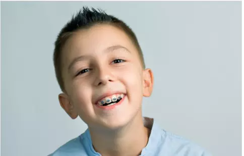 5 sfaturi pentru a-ți ajuta copilul să poarte aparat dentar