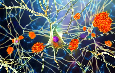 13 vedete cu afecțiuni neurodegenerative