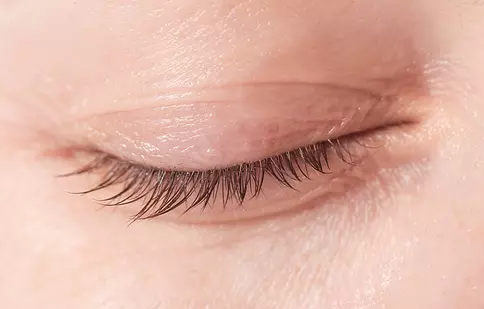 12 cele mai frecvente afecțiuni ale pleoapei