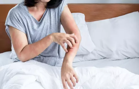 Semne care indică prezența ploșnițelor de pat și cum să le elimini