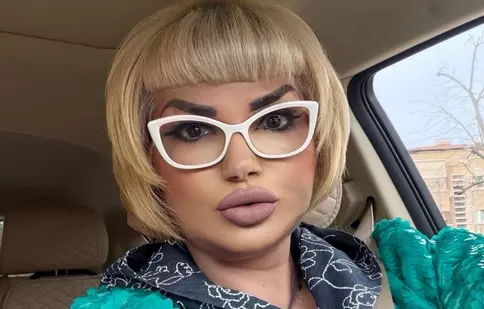 Cum arată Ozana Barabancea după liftingul facial. Ce a dezvăluit artista despre recuperare: „Rezultatul dorit”