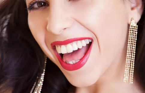 Cum îngrijești fațetele dentare? Precauția, cuvântul de ordine pentru zâmbetul perfect!
