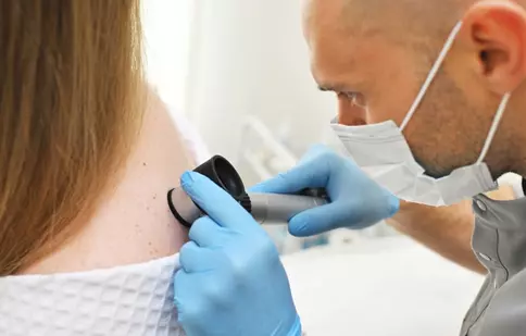 Tot ce trebuie să știi despre melanomul malign: factori de risc, semne și cum să îți monitorizezi corect alunițele