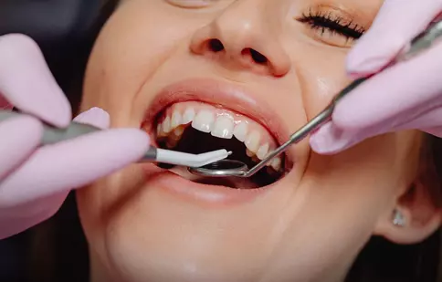 De ce alegerea medicului stomatolog contează la fel de mult ca alegerea tratamentului estetic dentar