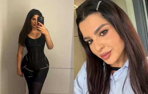 Ioana State, de nerecunoscut după ce a topit 30 de kilograme! Detaliul din spatele operației estetice pe care și-a făcut-o de la gât în jos