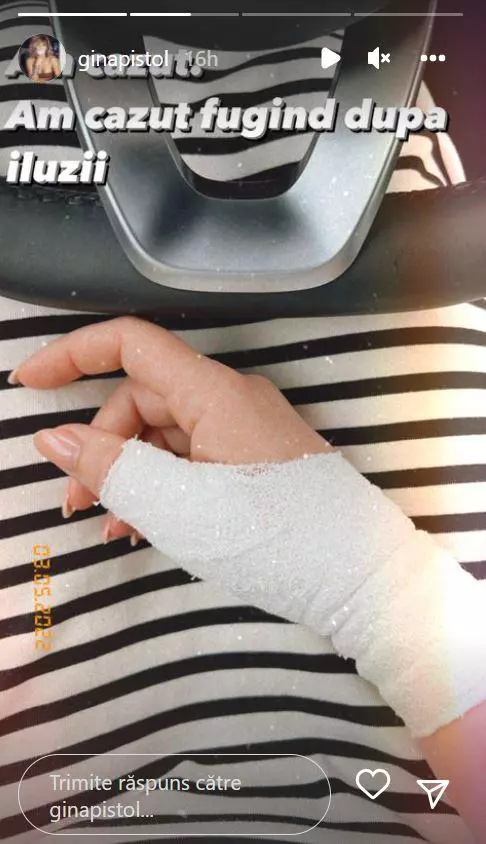 Gina cu mana bandajata