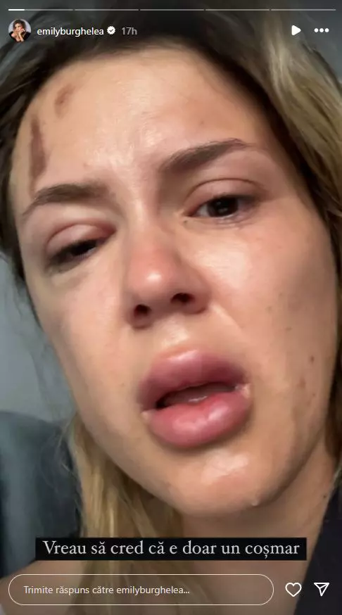 Emily Burghelea a suferit un accident grav de mașină  (4)