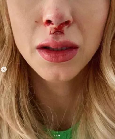 andreea-balan-cazut-1