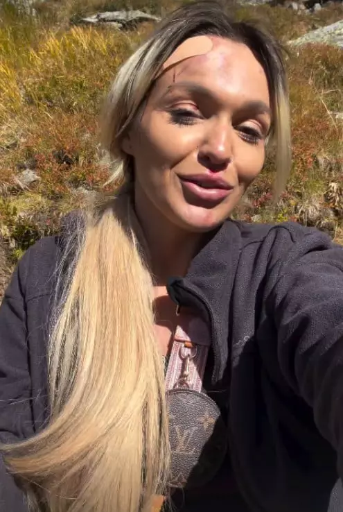 ella-visan-survivor-romania-2027-accident-varful-negoiu (4)