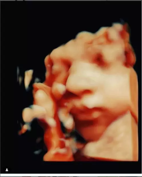 ecografie fiu reghecampf