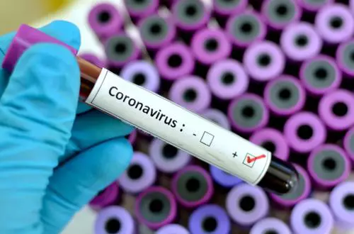 coronavirus-2-china-1-3