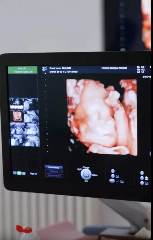 laura-cosoi-confirma-a-cincea-fetita-gender-reveal-imagini (8)
