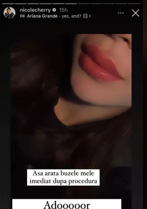nicole-chery-buze-1