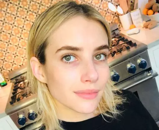 vedete-endometrioza-2