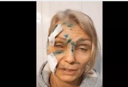 femeie-insangerata-8-1