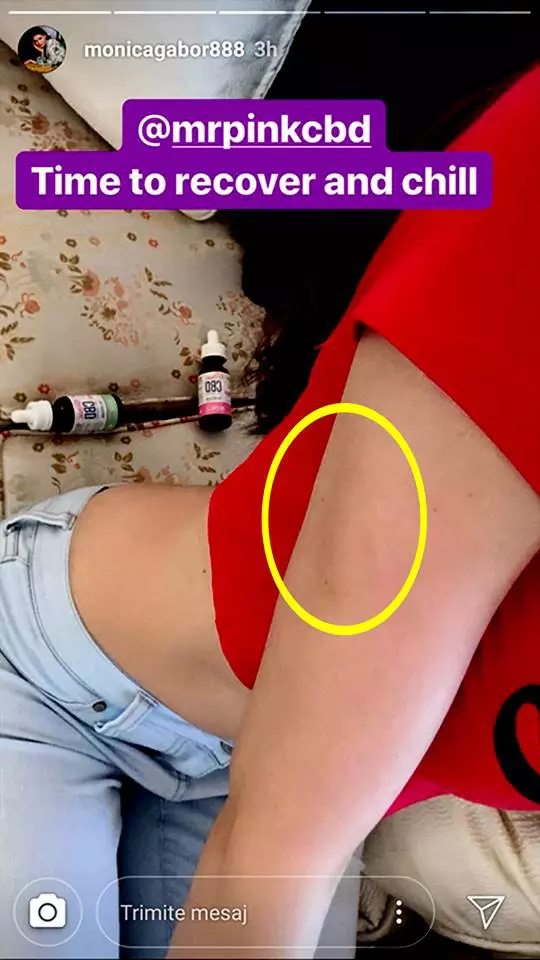 Monica Gabor are vânătăi pe corp