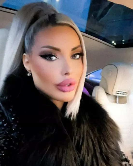 loredana-chivu-avort-spontan-7