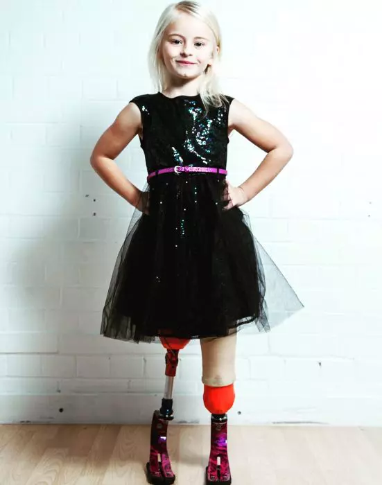 The Little Girl With No Legs And Big Dreams