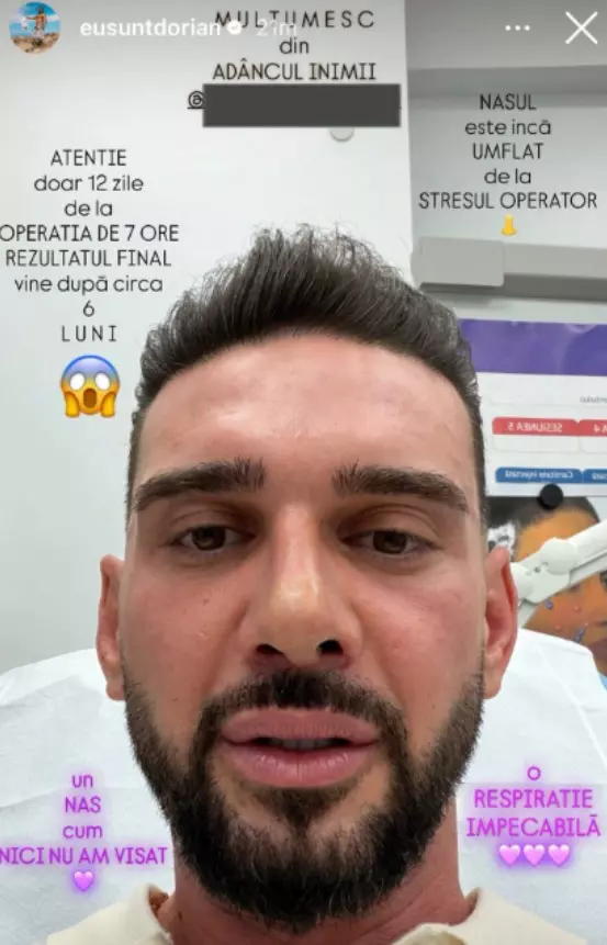 dorian popa dupa operatia la nas