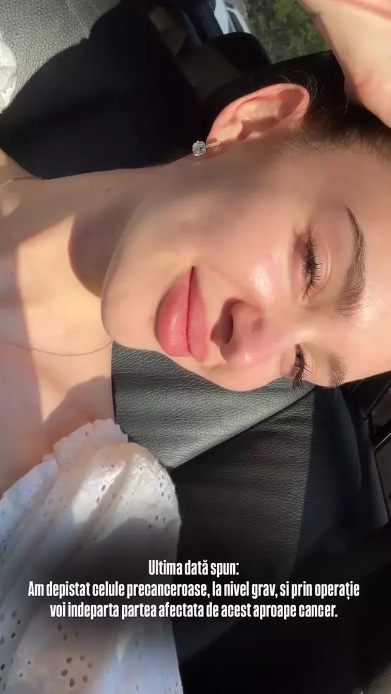 olga verbitchi boala