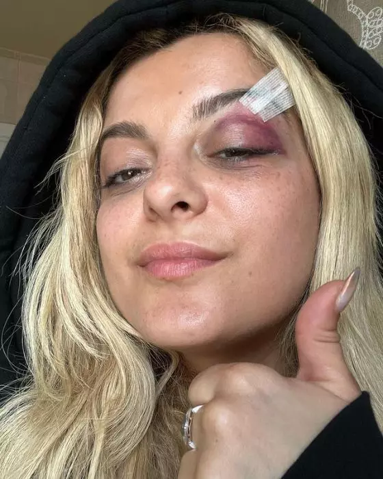 bebe-rexha-vanataie-3