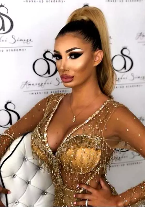 Lorena-Tonciu-după-interven_iile-estetice