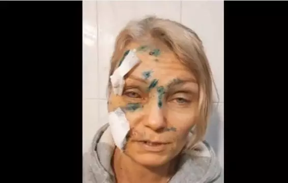 femeie-insangerata-6-1