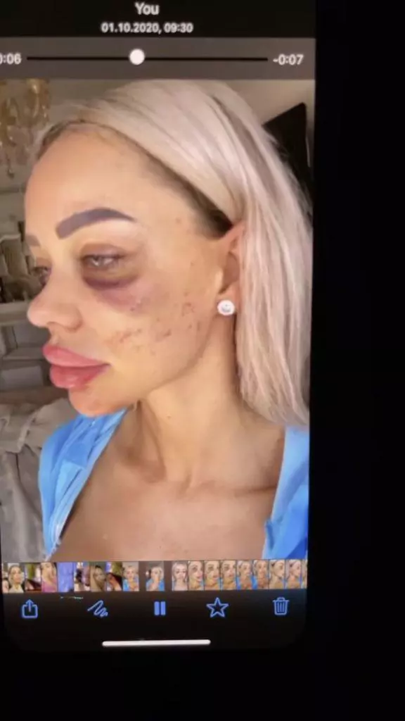 Bianca-Dragusanu-batuta-10-576x1024