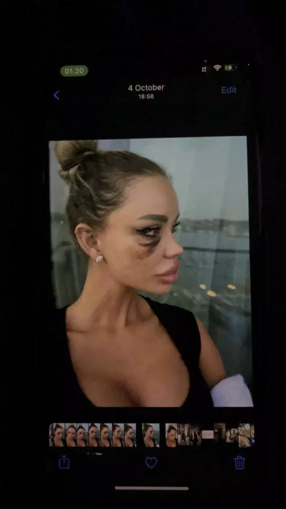 Bianca-Dragusanu-batuta-2-576x1024