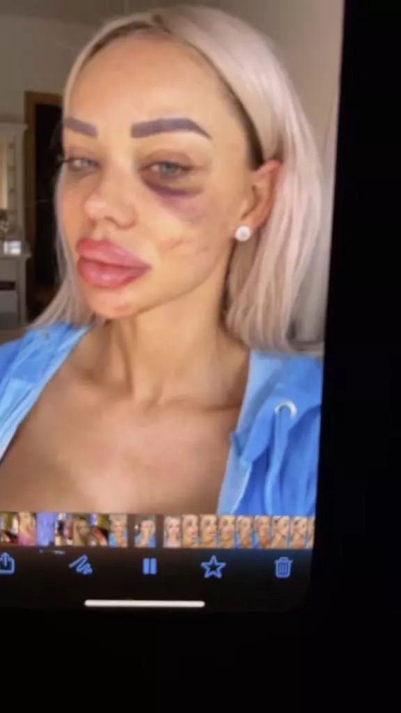 Bianca-Dragusanu-batuta-7-576x1024